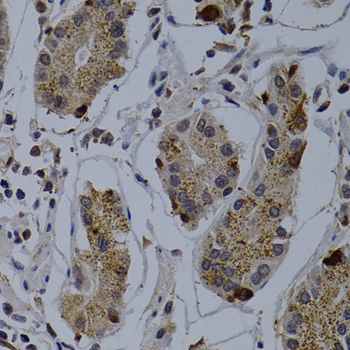 Immunohistochemistry - TNFRSF6B Polyclonal Antibody 