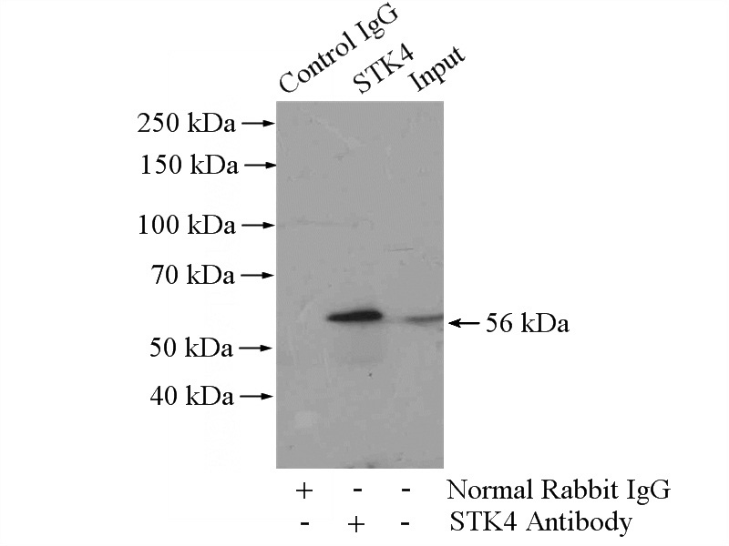 IP Result of anti-STK4 (IP:Catalog No:115725, 4ug; Detection:Catalog No:115725 1:1000) with HeLa cells lysate 1200ug.