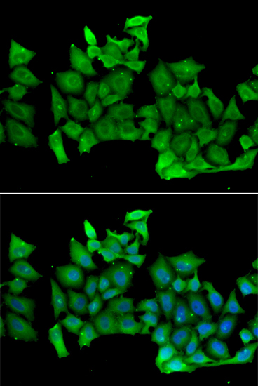 Immunofluorescence - RHOH Polyclonal Antibody 