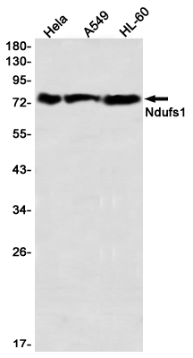 Western blot detection of Ndufs1 in Hela,A549,HL-60 using Ndufs1 Rabbit mAb(1:1000 diluted)