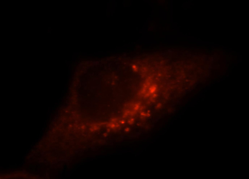 Immunofluorescent analysis of MCF-7 cells, using ITPA antibody Catalog No:109111 at 1:25 dilution and Rhodamine-labeled goat anti-rabbit IgG (red).