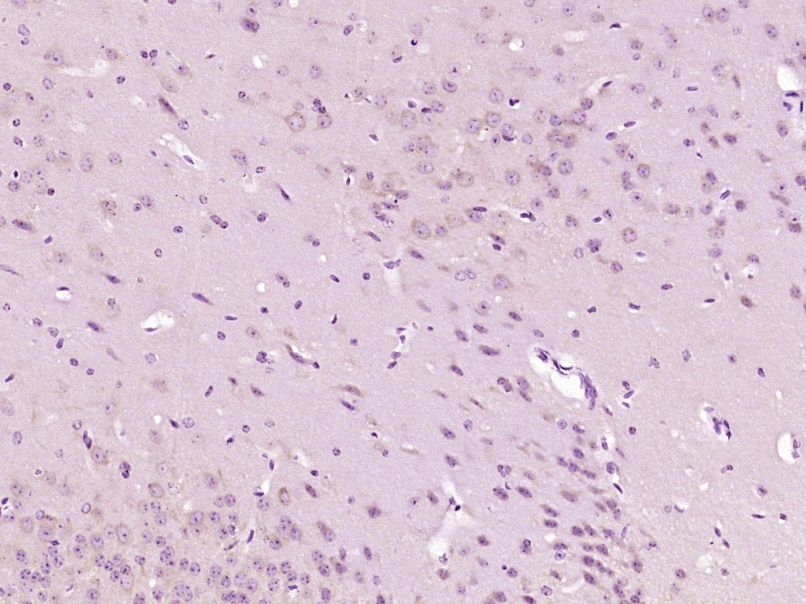 Fig2: Paraformaldehyde-fixed, paraffin embedded (Mouse brain); Antigen retrieval by boiling in sodium citrate buffer (pH6.0) for 15min; Block endogenous peroxidase by 3% hydrogen peroxide for 20 minutes; Blocking buffer (normal goat serum) at 37℃ for 30min; Antibody incubation with (GTP cyclohydrolase 1) Polyclonal Antibody, Unconjugated at 1:400 overnight at 4℃, followed by operating according to SP Kit(Rabbit) (sp-0023) instructionsand DAB staining.
