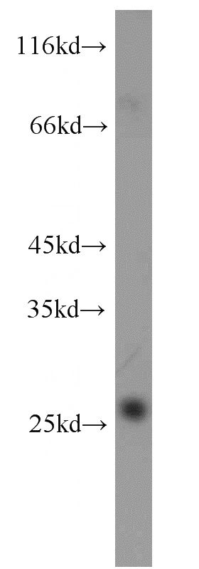 human kidney tissue were subjected to SDS PAGE followed by western blot with Catalog No:112875(MSRA antibody) at dilution of 1:800