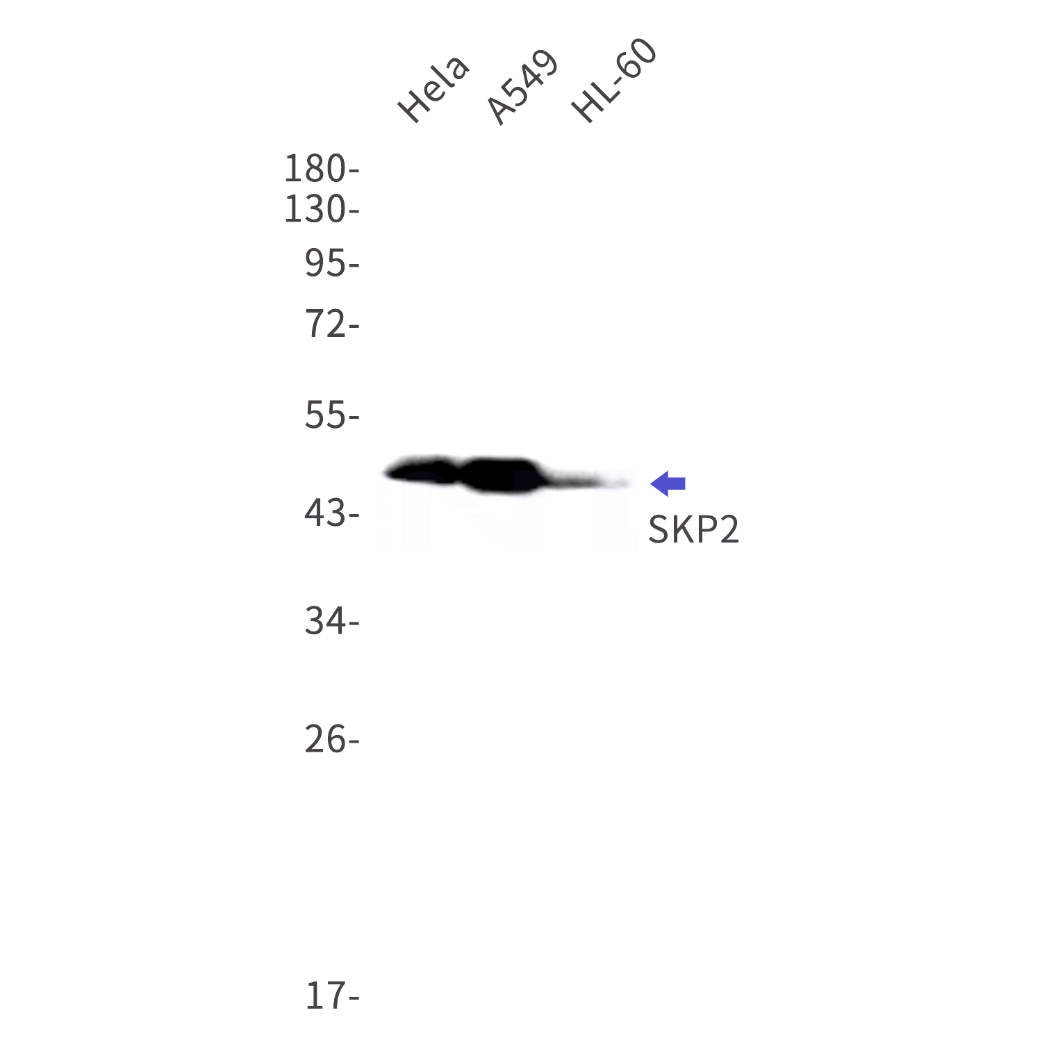 Western blot detection of SKP2 in Hela,A549,HL-60 cell lysates using SKP2 Rabbit mAb(1:1000 diluted).Predicted band size:48kDa.Observed band size:48kDa.