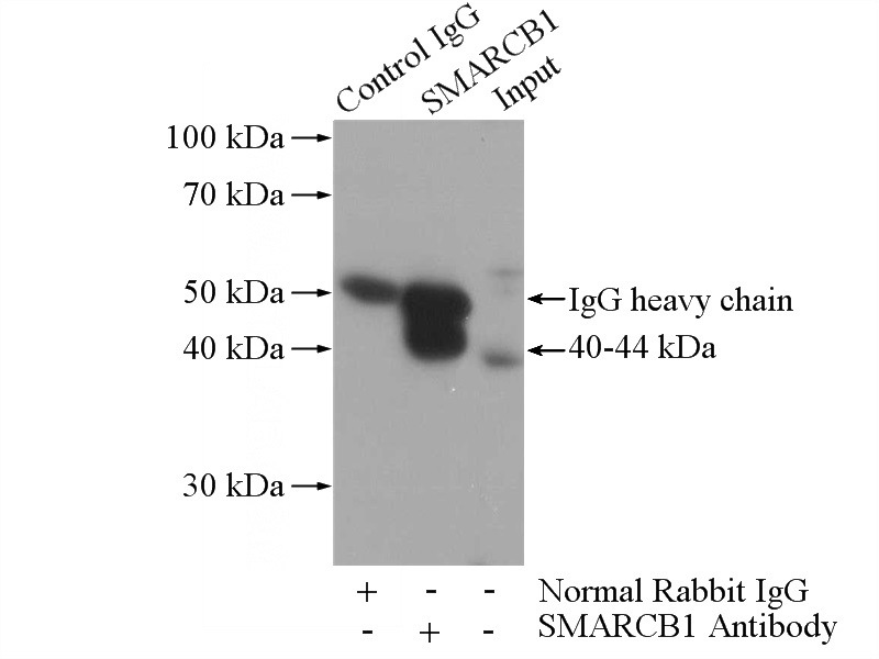 IP Result of anti-SMARCB1 (IP:Catalog No:115431, 4ug; Detection:Catalog No:115431 1:500) with K-562 cells lysate 3200ug.