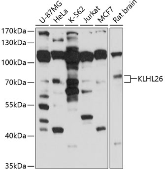Western blot - KLHL26 Polyclonal Antibody 