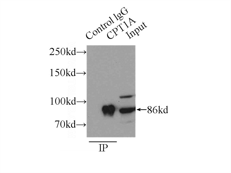 IP Result of anti-CPT1A (IP:Catalog No:109530, 3ug; Detection:Catalog No:109530 1:300) with HepG2 cells lysate 2000ug.