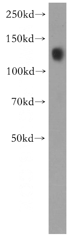 human kidney tissue were subjected to SDS PAGE followed by western blot with Catalog No:108773(CDH16 antibody) at dilution of 1:400