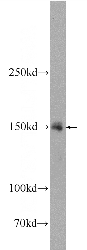 rat testis tissue were subjected to SDS PAGE followed by western blot with Catalog No:115960(TEX15 Antibody) at dilution of 1:300