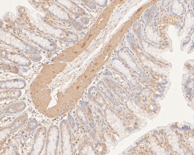 Fig2:; Immunohistochemical analysis of paraffin-embedded rat large intestine tissue using anti-DNA2 antibody. The section was pre-treated using heat mediated antigen retrieval with sodium citrate buffer (pH 6.0) for 20 minutes. The tissues were blocked in 5% BSA for 30 minutes at room temperature, washed with ddH; 2; O and PBS, and then probed with the primary antibody ( 1/400) for 30 minutes at room temperature. The detection was performed using an HRP conjugated compact polymer system. DAB was used as the chromogen. Tissues were counterstained with hematoxylin and mounted with DPX.