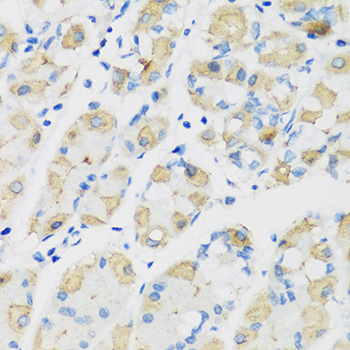 Immunohistochemistry - ATP4B Polyclonal Antibody 