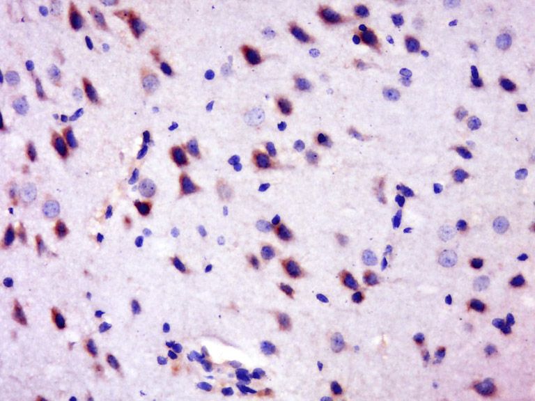 Fig2: Paraformaldehyde-fixed, paraffin embedded (Rat brain); Antigen retrieval by boiling in sodium citrate buffer (pH6.0) for 15min; Block endogenous peroxidase by 3% hydrogen peroxide for 20 minutes; Blocking buffer (normal goat serum) at 37℃ for 30min; Antibody incubation with (IMPACT) Polyclonal Antibody, Unconjugated at 1:400 overnight at 4℃, followed by operating according to SP Kit(Rabbit) (sp-0023) instructions and DAB staining.