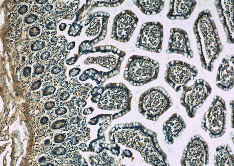Immunohistochemistry of paraffin-embedded human small intestine slide using Catalog No:117188(BLoc1S1-Specific Antibody) at dilution of 1:50