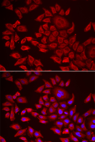 Immunofluorescence - AGPAT2 Polyclonal Antibody 