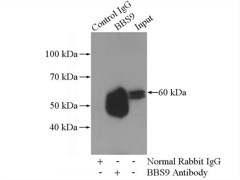 IP Result of anti-BBS9 (IP:Catalog No:108377, 4ug; Detection:Catalog No:108377 1:500) with mouse testis tissue lysate 4000ug.