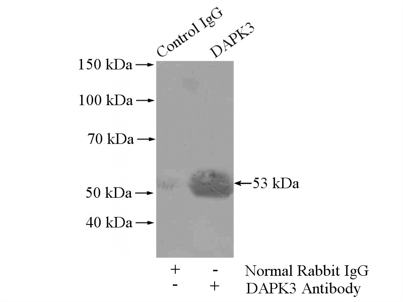 IP Result of anti-ZIPK-Phospho 311Ser (IP:Catalog No:117063, 4ug; Detection:Catalog No:117063 1:300) with HEK-293 cells lysate 3200ug.
