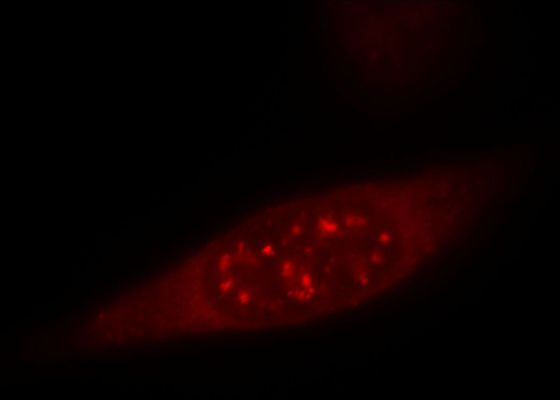 Immunofluorescent analysis of MCF-7 cells, using IL18 antibody Catalog No: at 1:25 dilution and Rhodamine-labeled goat anti-mouse IgG (red).