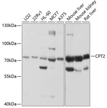 Western blot - CPT2 Polyclonal Antibody 