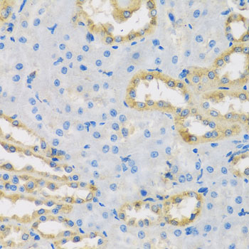 Immunohistochemistry - HS1BP3 Polyclonal Antibody 