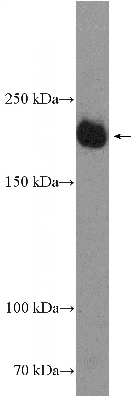 human placenta tissue were subjected to SDS PAGE followed by western blot with Catalog No:116736(KDR Antibody) at dilution of 1:600