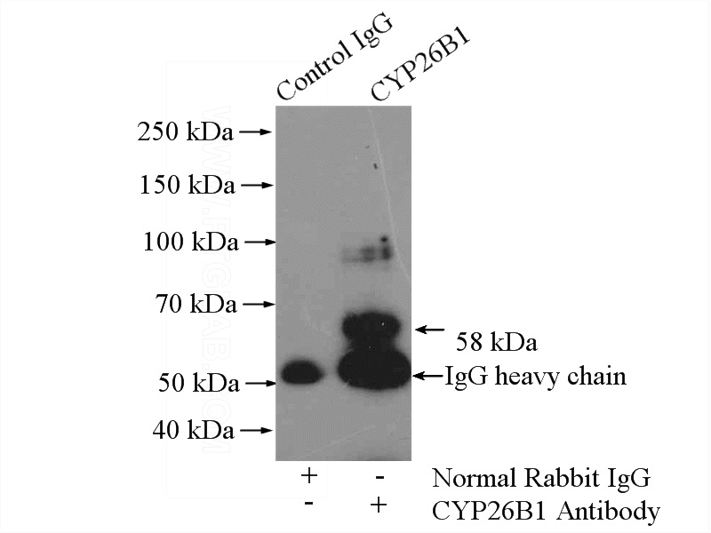IP Result of anti-CYP26B1 (IP:Catalog No:109688, 4ug; Detection:Catalog No:109688 1:500) with L02 cells lysate 2400ug.