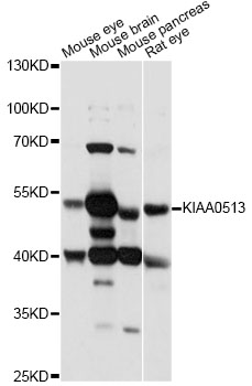 Western blot - KIAA0513 Polyclonal Antibody 