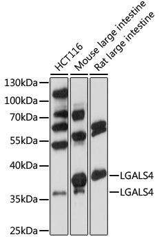 Western blot - LGALS4 Polyclonal Antibody 