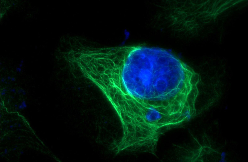 Immunofluorescent analysis of A431 cells using Catalog No:109807(KRT6A Antibody) at dilution of 1:50 and Alexa Fluor 488-congugated AffiniPure Goat Anti-Rabbit IgG(H+L)