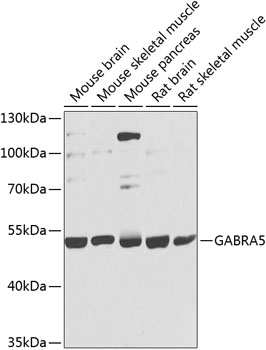 Western blot - GABRA5 Polyclonal Antibody 