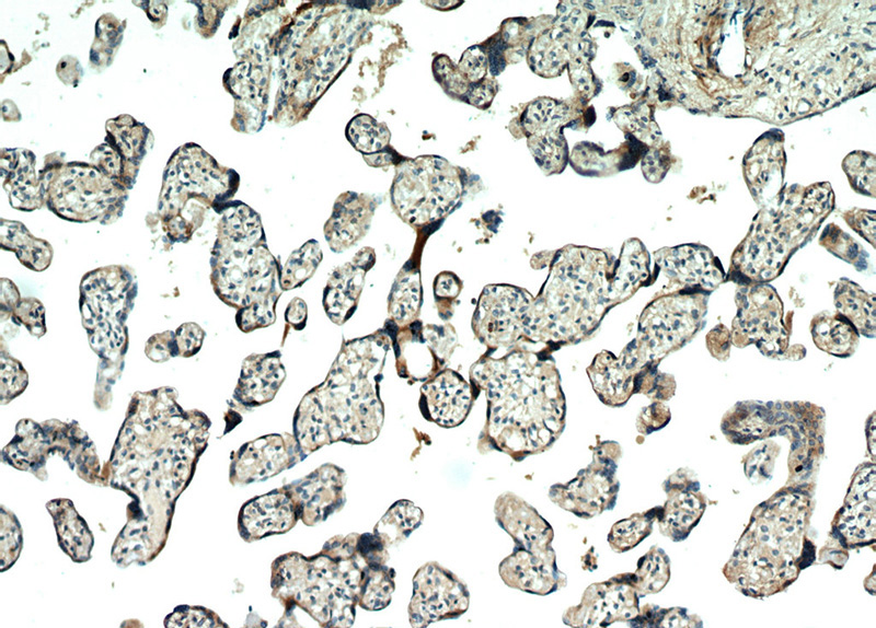 Immunohistochemical of paraffin-embedded human placenta using Catalog No:107672(AAMP antibody) at dilution of 1:100 (under 10x lens)