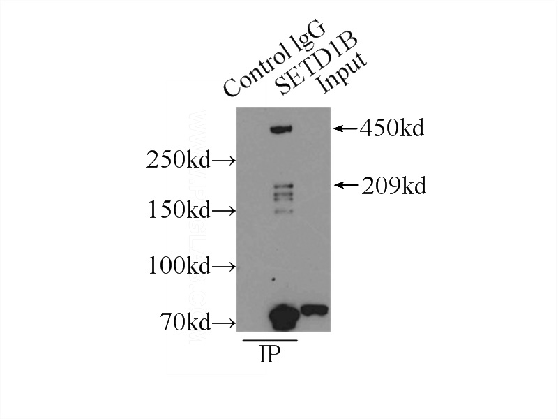 IP Result of anti-SETD1B (IP:Catalog No:115221, 5ug; Detection:Catalog No:115221 1:300) with MCF-7 cells lysate 3250ug.