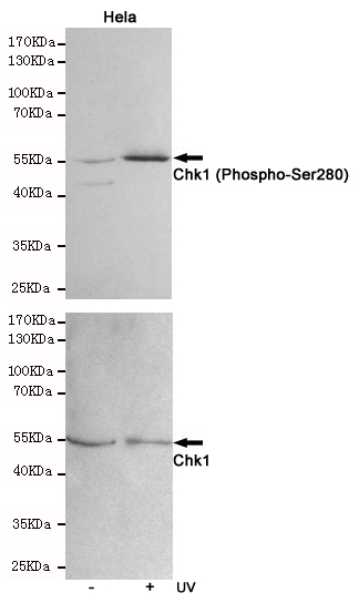 Western blot analysis of extracts from Hela cells, untreated or treated with UV, using Chk1 (Phospho-Ser280) Rabbit pAb (310037,1:500 diluted,upper) or CHK1 Mouse mAb (168441,1:500 diluted,lower).