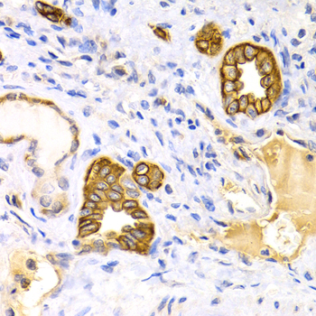 Immunohistochemistry - KRT15 Polyclonal Antibody 