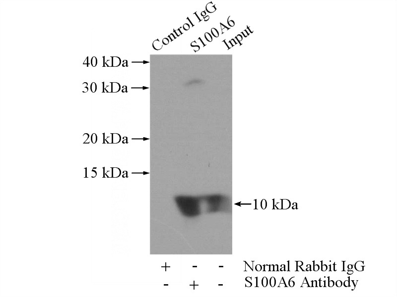 IP Result of anti-S100A6 (IP:Catalog No:114963, 3ug; Detection:Catalog No:114963 1:1000) with A549 cells lysate 2800ug.