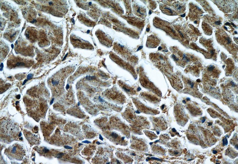 Immunohistochemistry of paraffin-embedded human heart tissue slide using Catalog No:112228(LIMK1 Antibody) at dilution of 1:200 (under 40x lens)