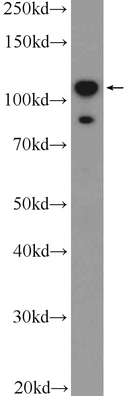 HepG2 cells were subjected to SDS PAGE followed by western blot with Catalog No:109977(DIS3L2 Antibody) at dilution of 1:600