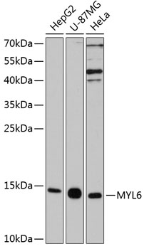 Western blot - MYL6 Polyclonal Antibody 