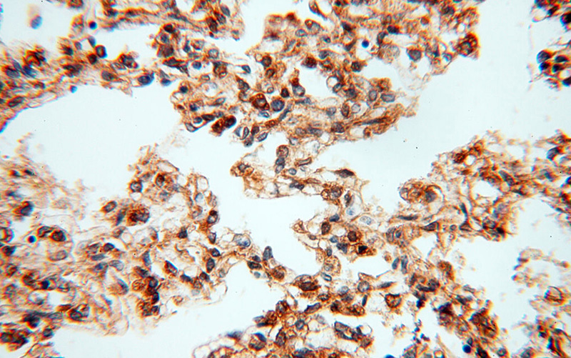 Immunohistochemical of paraffin-embedded human lung using Catalog No:109597(CSK antibody) at dilution of 1:200 (under 40x lens)