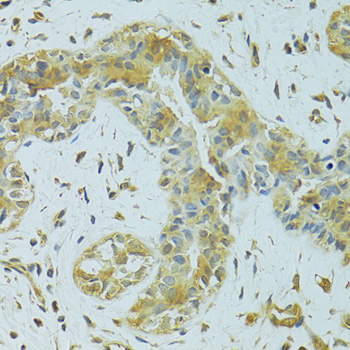 Immunohistochemistry - MTCH1 Polyclonal Antibody 