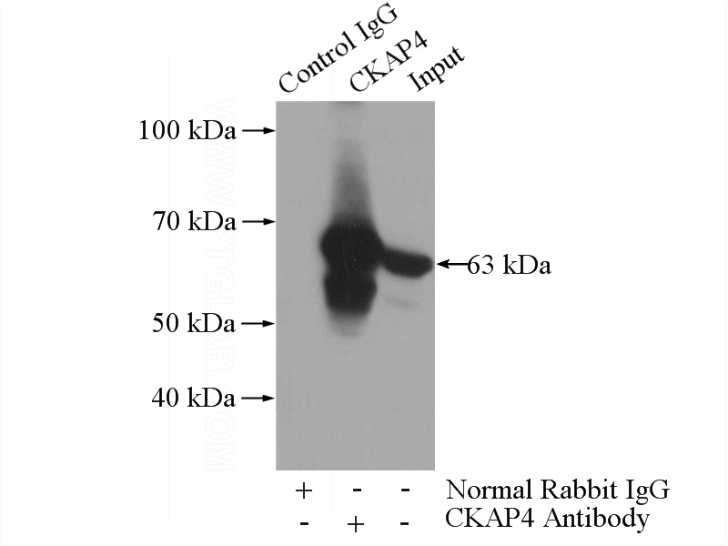 IP Result of anti-CKAP4 (IP:Catalog No:109328, 4ug; Detection:Catalog No:109328 1:1000) with HeLa cells lysate 2000ug.