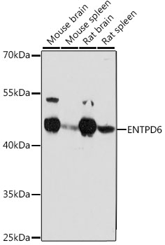 Western blot - ENTPD6 Polyclonal Antibody 