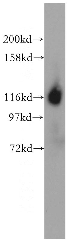 Jurkat cells were subjected to SDS PAGE followed by western blot with Catalog No:111591(ICAM3 antibody) at dilution of 1:500