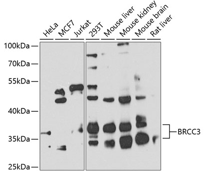 Western blot - BRCC3 Polyclonal Antibody 