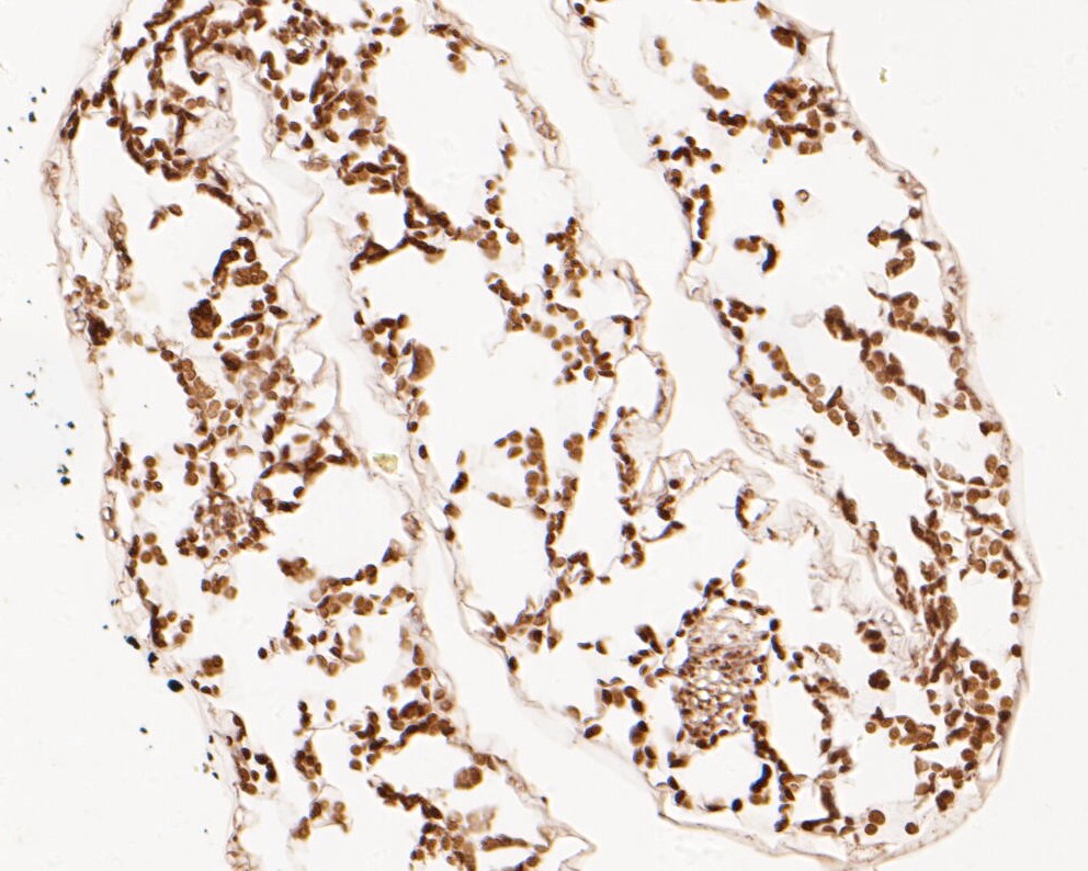 Fig2:; Immunohistochemical analysis of paraffin-embedded A. thaliana tissue using anti-FAB1A antibody. The section was pre-treated using heat mediated antigen retrieval with Tris-EDTA buffer (pH 9.0) for 20 minutes.The tissues were blocked in 5% BSA for 30 minutes at room temperature, washed with ddH; 2; O and PBS, and then probed with the primary antibody ( 1/50) for 30 minutes at room temperature. The detection was performed using an HRP conjugated compact polymer system. DAB was used as the chromogen. Tissues were counterstained with hematoxylin and mounted with DPX.