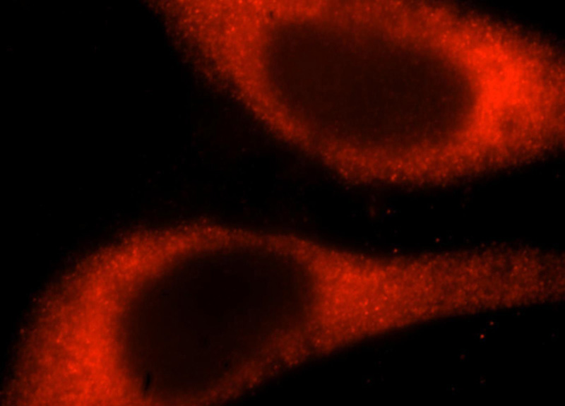 Immunofluorescent analysis of HepG2 cells, using RPS14 antibody Catalog No:114829 at 1:25 dilution and Rhodamine-labeled goat anti-rabbit IgG (red).