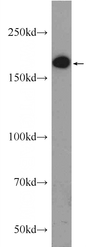 HeLa cells were subjected to SDS PAGE followed by western blot with Catalog No:110352(ERCC6 Antibody) at dilution of 1:1000