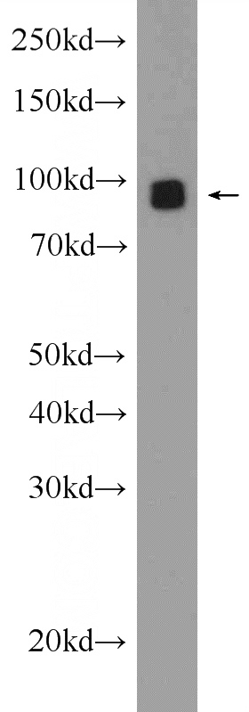 Neuro-2a cells were subjected to SDS PAGE followed by western blot with Catalog No:111019(SLC1A3 Antibody) at dilution of 1:1000