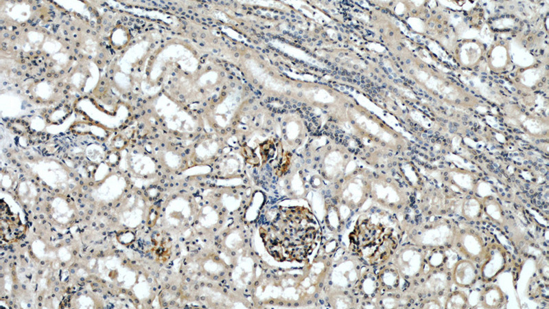 Immunohistochemical of paraffin-embedded human kidney using Catalog No:113988(PODXL antibody) at dilution of 1:50 (under 10x lens)