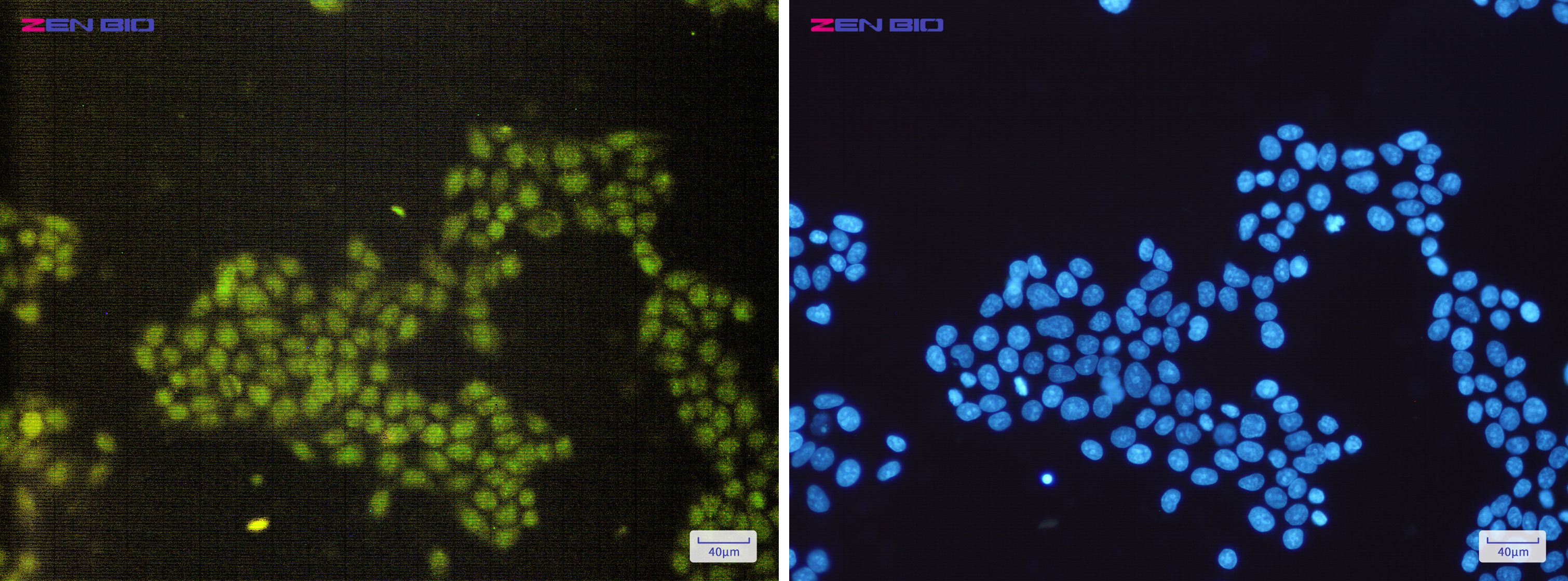 Immunocytochemistry of SAE1(green) in Hela cells using SAE1 Rabbit mAb at dilution 1/200, and DAPI(blue)