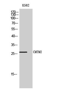 Fig1:; Western Blot analysis of K562 cells using CMTM2 Polyclonal Antibody